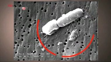 19 décès à Nice : une bactérie multirésistante suspectée