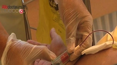 Cancer du poumon : une simple prise de sang pour reconnaître les nodules malins ?