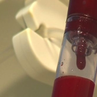 Les leucémies de l'enfant et de l'adulte, l'espoir d'un nouveau traitement