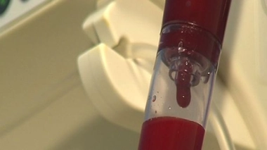 Les leucémies de l'enfant et de l'adulte, l'espoir d'un nouveau traitement