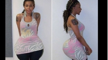 Le faux chirurgien Oneal Ron Morris (Source: Miami Gardens Police Departement)