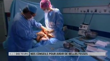 Avoir de belles fesses : que penser des implants fessiers ?