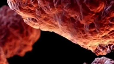 Le dépistage systématique du cancer de l'ovaire conduirait à réduire la mortalité