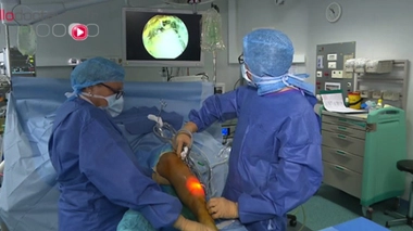 Le syndrome des loges : muscles asphyxiés