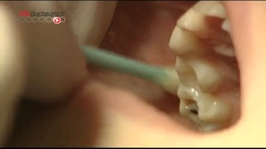 Les cellules souches, nouvel espoir pour les dentistes