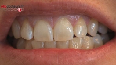 Les dentistes montrent les crocs contre la réforme de leurs tarifs