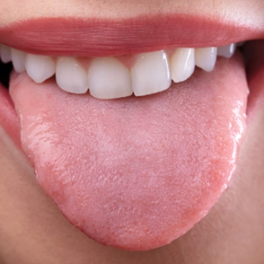 La langue et ses pathologies