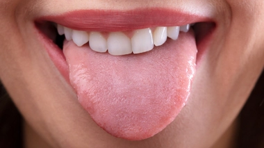 La langue et ses pathologies