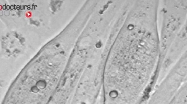 Du tissu pulmonaire grâce aux cellules souches