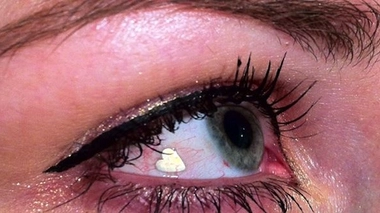 Une coquetterie dans l'œil