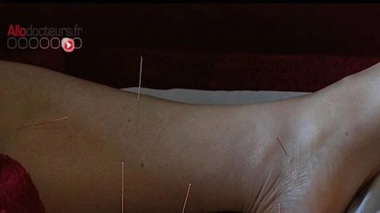 Ch@t : Et si on essayait l'acupuncture ?