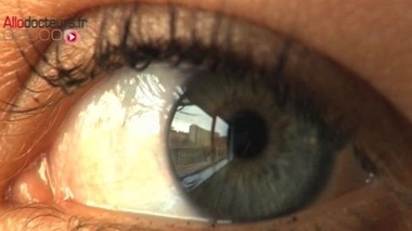 Glaucome : une lentille de contact qui diffuse des médicaments