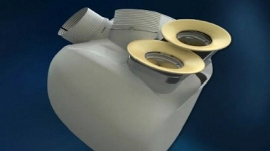 Le premier cœur artificiel définitif implanté au monde… est français !