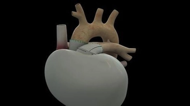 Depuis la première implantation du coeur Carmat®, aucune communication scientifique officielle n'avait été faite par les chercheurs 