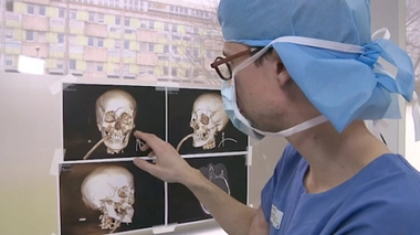 Chirurgie du visage : une véritable reconstruction