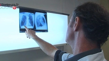 Emphysème pulmonaire : une maladie respiratoire mal connue