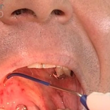 Retrouver le sommeil... sans les ronflements !