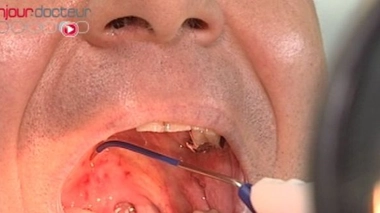 Retrouver le sommeil... sans les ronflements !