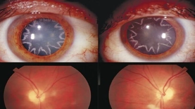 Une décharge électrique détruit ses yeux