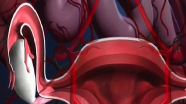 Ch@t : Kystes ovariens, quels traitements ?