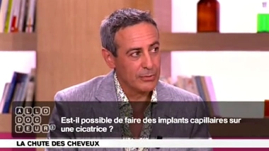 Peut-on faire des implants capillaires sur une cicatrice ?