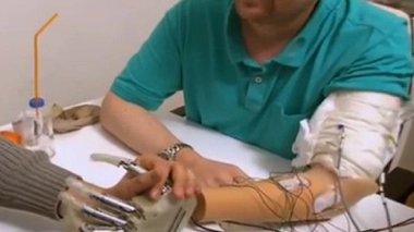 Il retrouve le sens du toucher grâce à une nouvelle prothèse