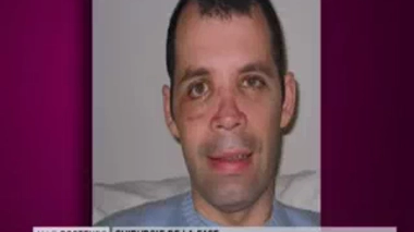 La chirurgie de la face est-elle douloureuse ?