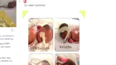 Grossesse multiple : elle en attendait trois, en voilà quatre !