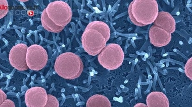 Méningite : trois décès confirmés à Nice