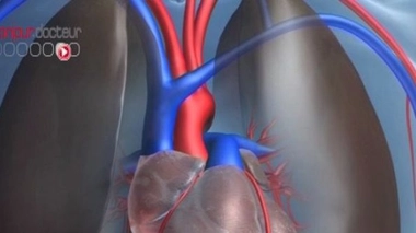 Ch@t : Troubles du rythme cardiaque