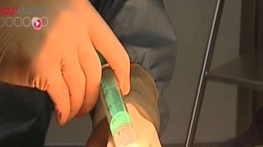 Ménopause : un nouveau traitement contre les bouffées de chaleur ?