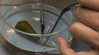 Du venin de mollusque cent fois plus puissant que la morphine