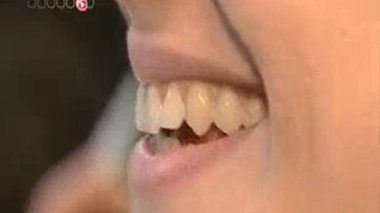 La qualité de la salive directement liée à la prise de poids