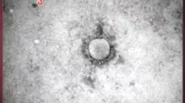 Coronavirus : premier cas recensé en Europe