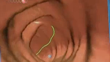 Stress et maux de ventre : le cerveau influence-t-il l'intestin ?