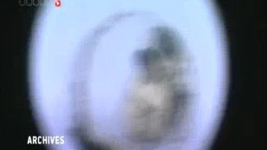 Bisphénol A : conséquences sur l'audition et le métabolisme ?