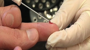 Pour une stratégie plus ambitieuse contre les hépatites