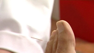 Ch@t  : Médecines complémentaires