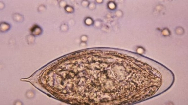 Oeuf de Schistosoma haematobium (ver responsable de la bilharziose uro-génitale). (Crédit photo : CDC)