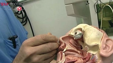 Acromégalie : les hormones de croissance en excès