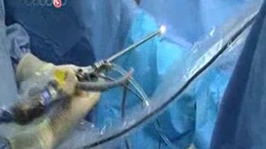 Cancer invasif de la vessie : l'espoir d'un traitement ciblé