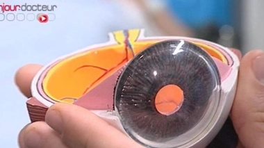 Ch@t : Au coeur de la vue