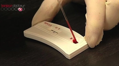 VIH : un tiers de séropositivités découvertes trop tardivement