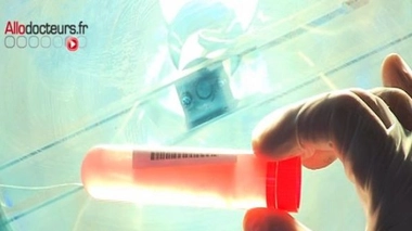 La cirrhose pourrait bientôt être dépistée dans les selles