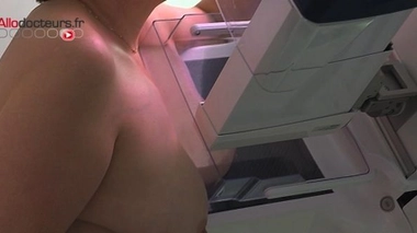Cancer du sein : découverte d'un nouveau gène défectueux