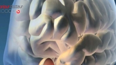 Une prothèse rétinienne intégralement remboursée