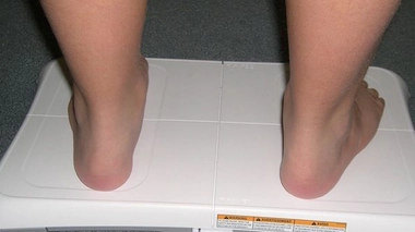 Sclérose en plaques : la Wii pour améliorer l'équilibre