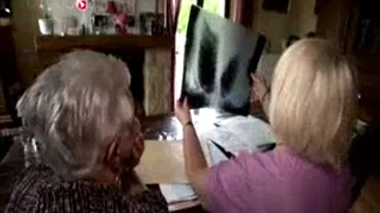 Les personnes atteintes de dyskinésie ciliaire primitive souffrent de bronchites ou sinusites chroniques depuis la naissance.