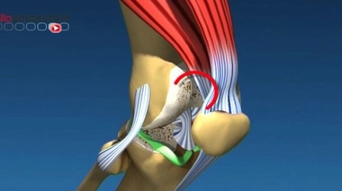 Arthrose : comment soulager la douleur ?