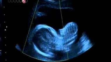 Les maisons de naissance encadrées par la HAS